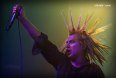 The Casualties